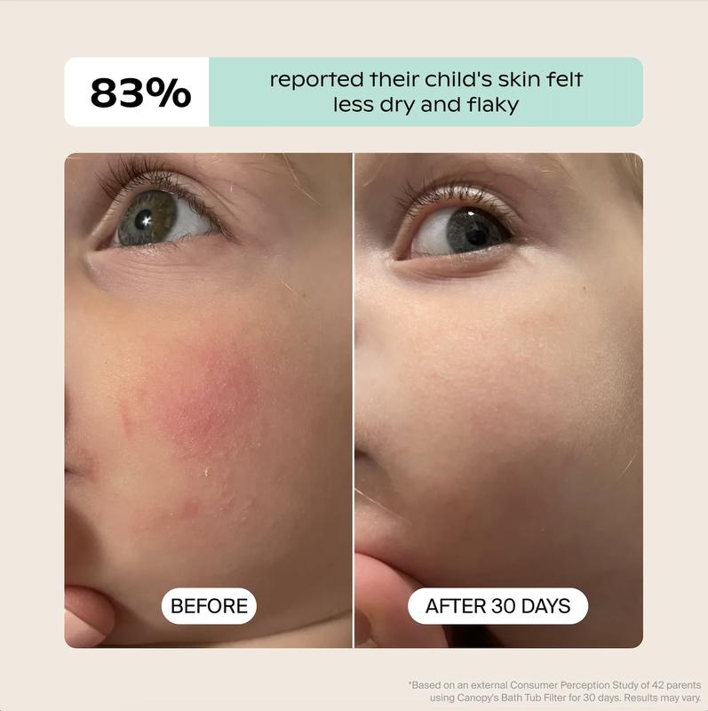 Baby Bath Tub Filter